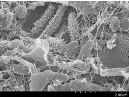 Figure 1 : Biofilm sur un grain de sable. (Source Google image) 