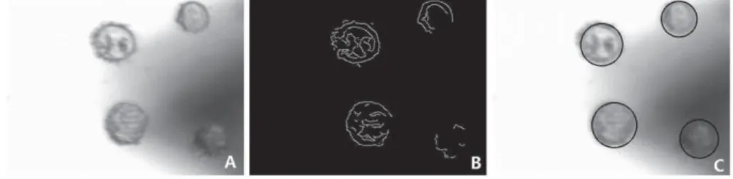 Figure 4.6.: Cell detection method on fixed Raji cells in the video image.