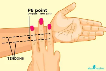 Figure 7 : Point d’acupuncture P6 pour le traitement des nausées et  vomissements  (92)