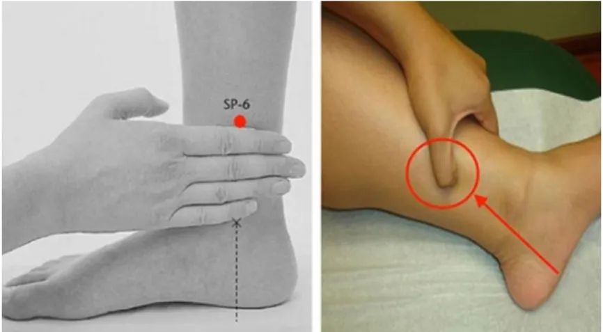 Figure 10 : point d’acupuncture SP6 ou point Sanyinjiao (107) 