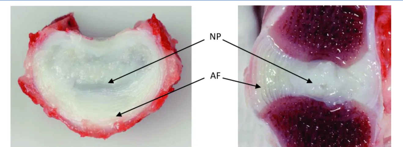 Figure 1.2. Transverse (left) and sagittal (right) section through a L5-L6 IVD of a 2-years old  chondrodystrophic dog, showing a fibrocartilaginous NP, a widened transition zone, and a 
