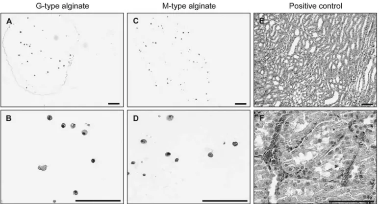 Figure 4.  PCNA immunostaining of encapsulated MSCs. Proliferating cell nuclear antigen (PCNA)-immunostained G-type (A and  B) and M-type (C and D) microspheres after 28 days postencapsulation