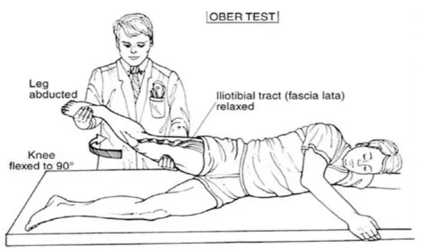 Figure 3 : test de Ober (9). 