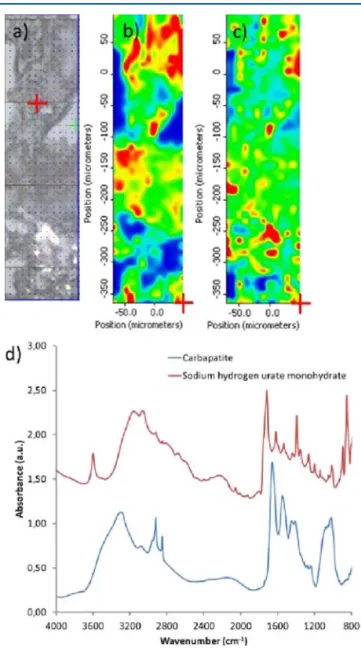 Figure 8. Optical image and mapping of an area of a kidney biopsy (scale from blue to red with the concentration increase), and FT-IR spectra of crystals