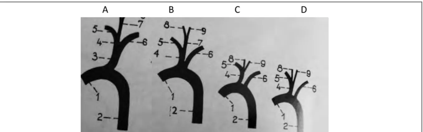 Figure I.24 : Origine des artères carotides et des troncs brachiaux sur l’aorte chez le cheval (A) chameau (B), le lama (C),  et les carnivores domestiques (chien/chat) (D)