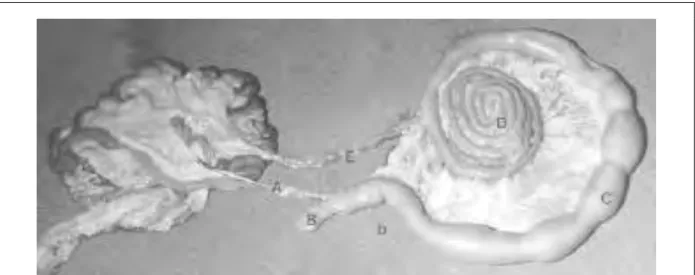 Figure I.36 : intestins d’un lama adulte. A=iléon ; B=caecum ; C=boucle proximale du colon spiral ; D=colon spiral ;  E=colon transverse