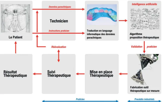 Figure 11 : Conception actuelle de l’outil thérapeutique orthodontique par  procédé  CAD/CAM  (image  du  procédé  industriels  du  robot  de  SureSmile® 