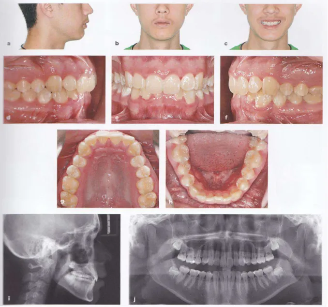 Figure 12 : Bilan photographique et radiographique complet (51) 