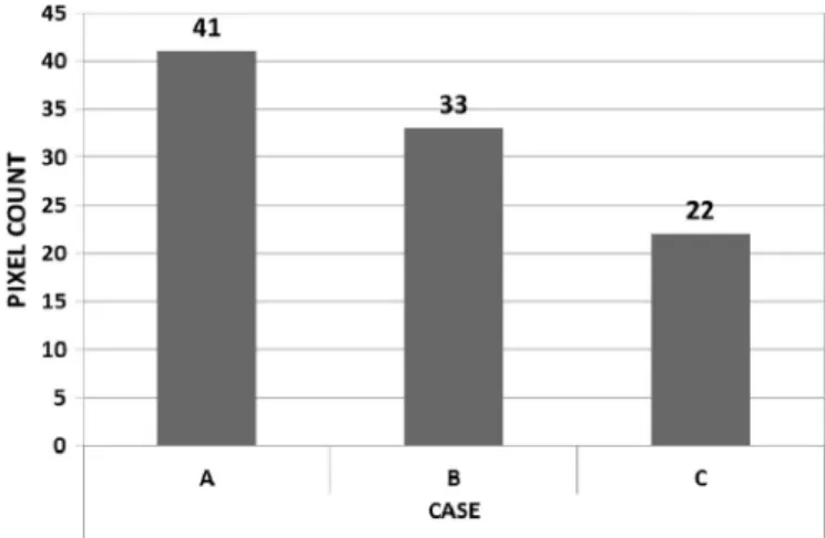 Fig. 11. Noisy pixel number versus TID for four noise detection levels: 500, 600, 700, and 800 μV rms.