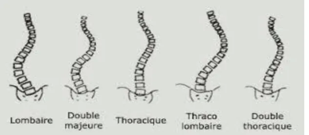 Figure 8 : Topographie des scolioses 