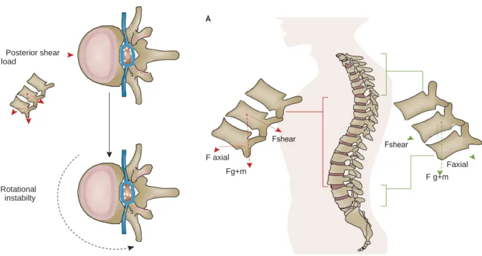 Figure 11 : Influence des charges de cisaillement sur la colonne vertébrale.  