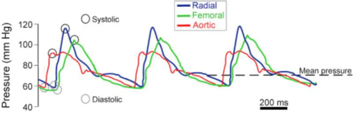 Figure 2 : Variations des composantes de la pression artérielle selon  le site de mesure