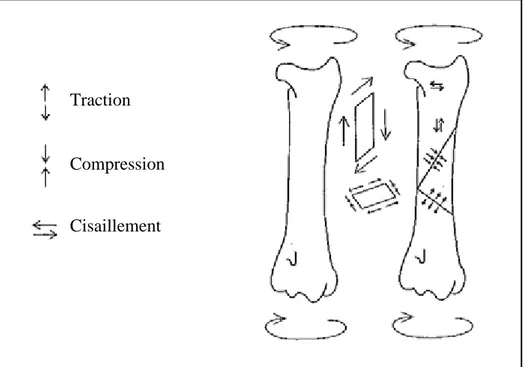 Figure 22 : Contraintes exercées sur l’os lors de l’application d’un couple de forces 
