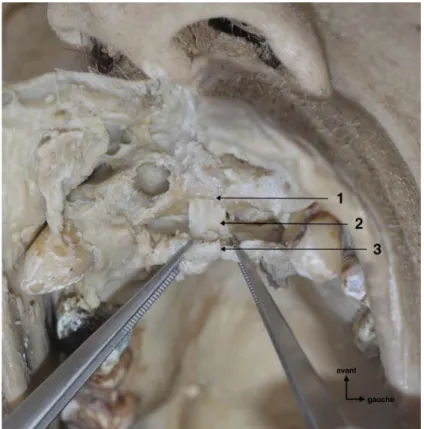 Figure   9 :   Photographie   endobuccale   sur   tête   disséquée   réalisée   au   laboratoire d'anatomie de la faculté de médecine de Lille centrée sur la région antérieure maxillaire.