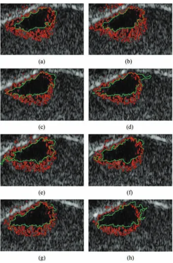 Fig. 11. 3-D segmentation of an eight-slice image. (a) Slice 1. (b) Slice 3.