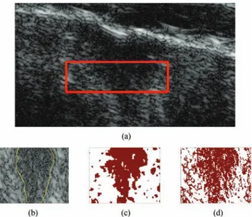 Fig. 8. Log-compressed US images of skin lesion and the corresponding estimated labels (white represents healthy white, red represents lesion) [1]).