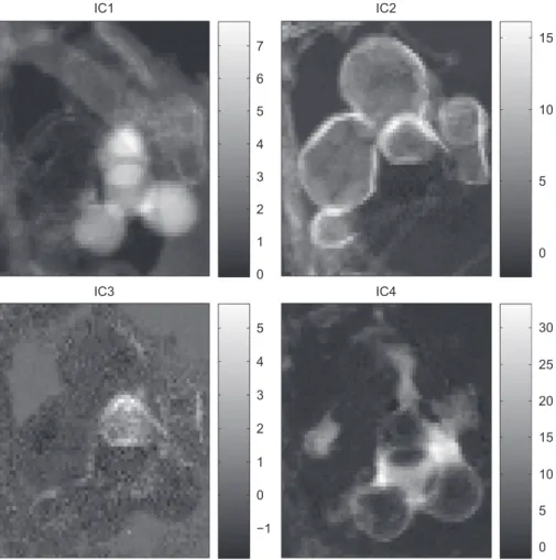 Fig. 9. Maps of the spectral components extracted by CubICA for a limited energy range (the spectral signatures are depicted in Fig