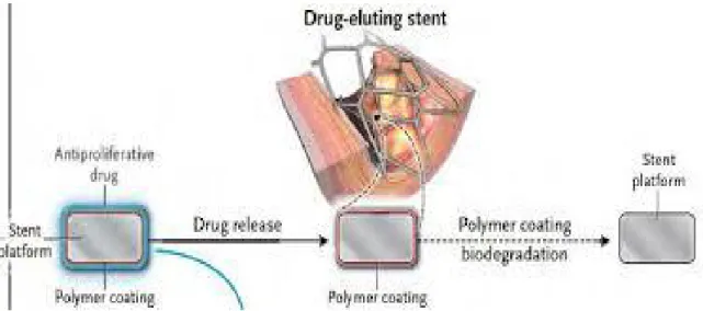 Tableau comparant les statistiques de thromboses de stent selon les différents  types de stent posés : 