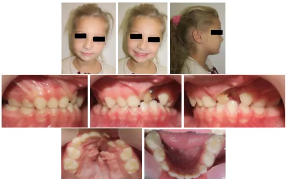Figure 18 : Exemple de bilan photographique d’un patient en début de traitement orthodontique