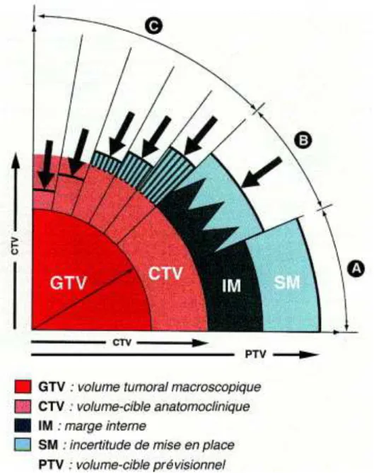 Figure 1.4 – Schéma des différents volumes de planification selon les recommandations de l’ICRU