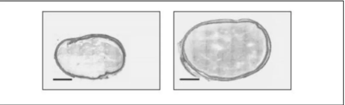 Figure 6 : Comparaison de la largeur du caecum d’un rat sédentaire par rapport à un  rat qui fait de la roue d’exercice (28) 