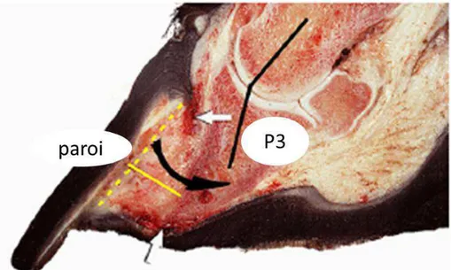 Figure 10 : Coupe transversale de la région lamellaire d'un pied atteint de fourbure chronique montrant  l'apparence macroscopique du &#34;lamellar wedge&#34; (d'après Collins, 2010)