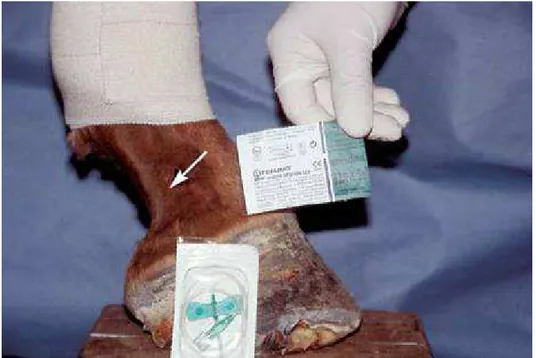 Figure 16 : Le cathéter a été introduit dans la veine digitale palmaire latérale, et le tourniquet  va être mis en place sur le bandage adhésif (d'après Redden, 2001a)
