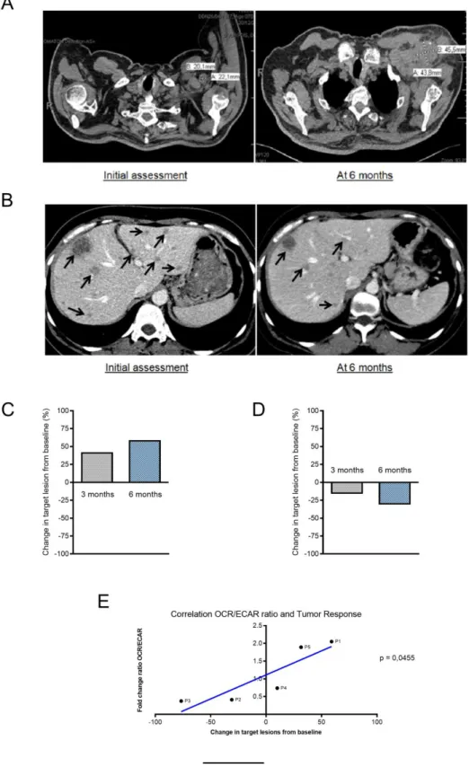 Figure  4: Analysis  of  the  correlation  between  the  evolution  of  the  tumor  response  and  the  metabolic  modifications  of  the  immune  populations  under  anti-PD-1  immunotherapy