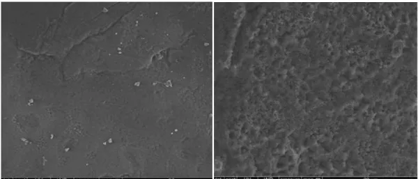 Figure 10 : Surface de l'émail avant (G) et après (D) mordançage 