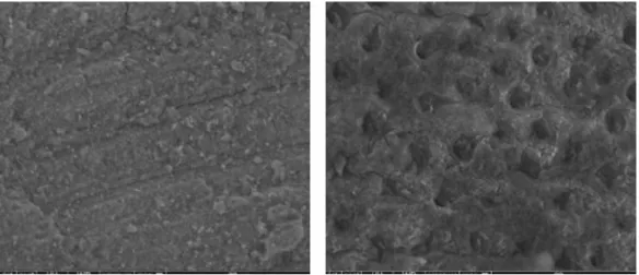 Figure 11 : Surface de dentine avant (G) et après (D) mordançage 
