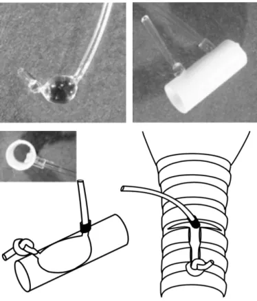 Figure I.8 : Méthode du ballon trachéal pour mimer les apnées du sommeil 