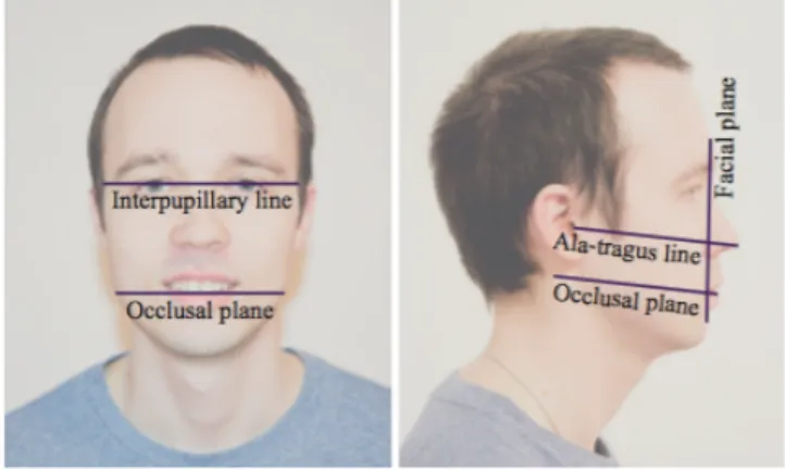 Figure 16 : Photos mettant en évidences les repères faciaux  6) Le rendu 