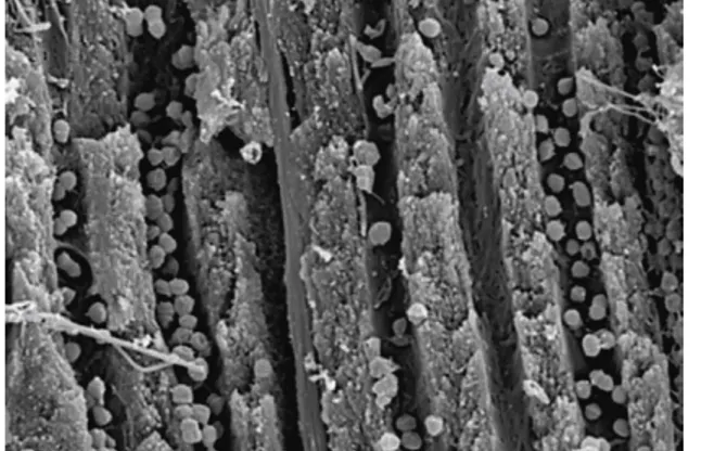 Figure 7 : Image prise au microscope à balayage (MEB) représentant des cocci  colonisant les tubuli dentinaires [65]