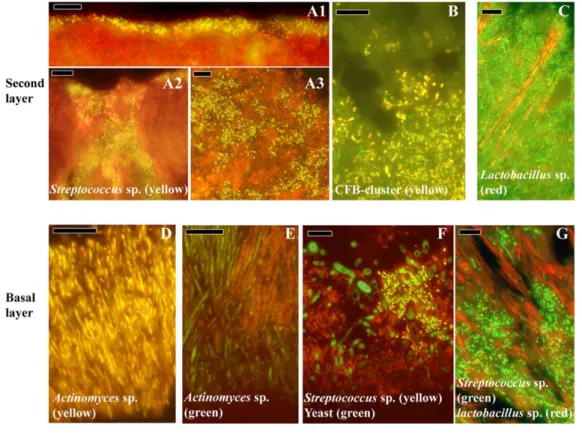 Figure  9  :  Les  différents  biofilms  supra-gingivales  par  des  images  prises  au  microscope optique et électronique [67]