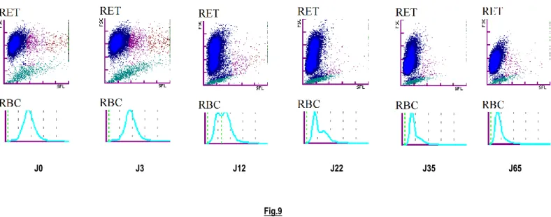 Figure 9 : Cas n°=5, Evolution de l’érythrogramme et du nuage de points établis par cytométrie en flux du cas n°=5