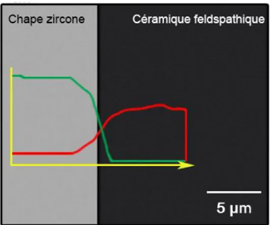 Figure 1 : Courbes de diffusion de la zircone (vert) et de la céramique feldspathique (rouge) à l’interface entre les  deux matériaux 