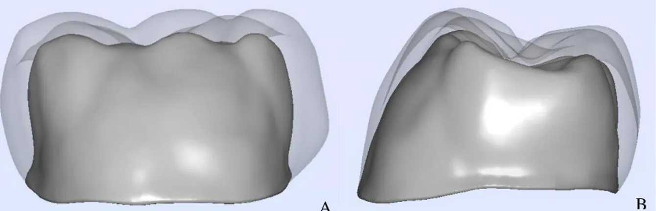 Figure 10 : Modélisation de l’armature de type homothétique avec un exemple de montage de stratification