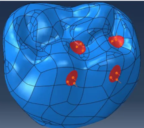 Figure 16 : Situation des quatre surfaces d’appui sur la couronne 