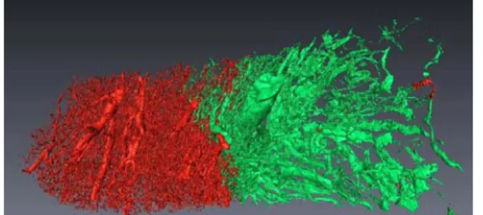 Fig. 6. Result: normal tissue (red) and tumor (green) (β = 5)