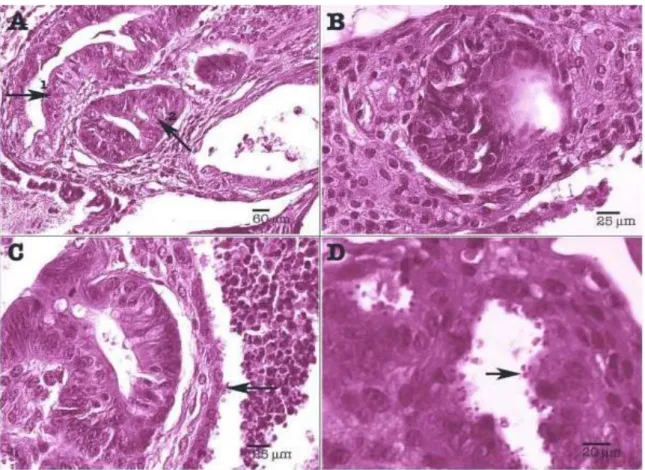 Figure IV-4 Modèle expérimental de souris SCID-D infectées par C. parvum lésions histologiques de la  région  caecale