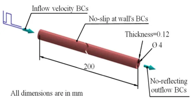 Figure 1-9 The long elastic tube model and boundary conditions 