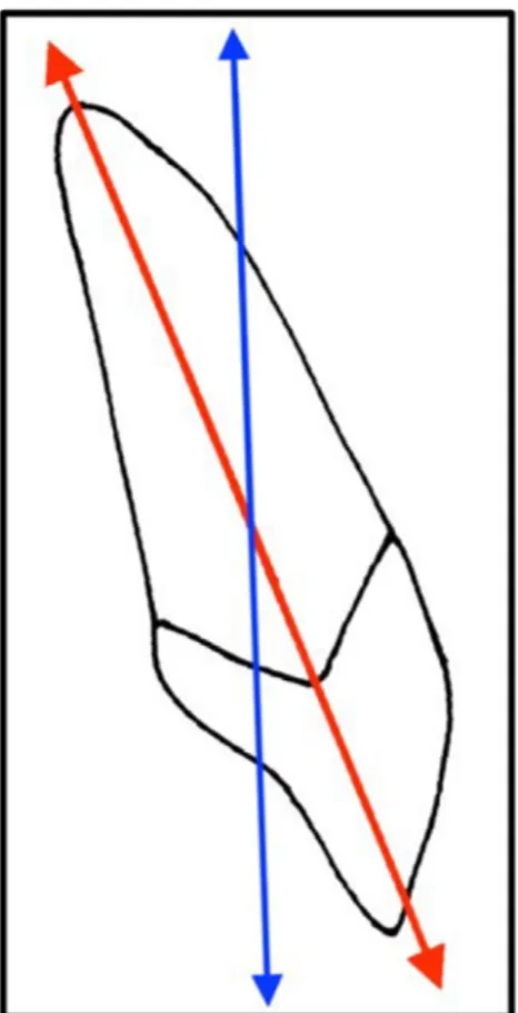 Figure 4 : Axe de l'incisive maxillaire dans le plan sagittal : la flèche bleue correspond à l’axe sagittal et la flèche rouge au  grand axe de la dent   