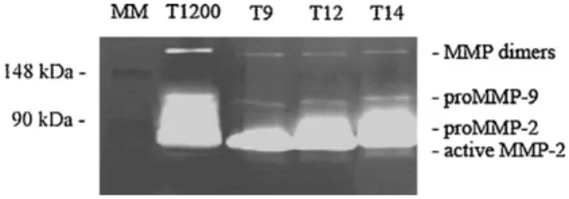 Fig. 7. Gelatin-zymographic determination of the MMP secreted by HGF-1 cells maintained in contact for 72 h with: native-oxide covered Ti surface (lane 2), and MOCVD-TiO 2 coated specimens: T9 (lane 3), T12 (lane 4), and T14 (lane 5)