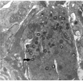 Figure 8: A Capripox virion from the skin of Capripox infected goat; the virus particle is  indicated by arrow; Source: Babiuk et al., 2008a