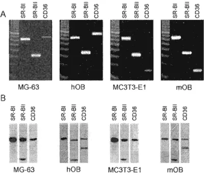 Figure  2.3  :  Determination  of mRNA  and  protein  expression  for  SR-BI,  SR-BIT  and  CD36  in  osteoblastic cells