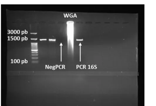 Figure 16 – Détection sur gel d’électrophorèse des produits issus de l’amplification du  génome entier (WGA) et du fragment à 1300pb issue de la PCR (PCR 16S)