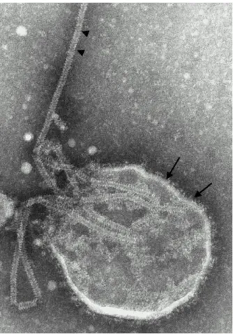 Figure 4 : Image de microscopie électronique du virus Nipah montrant les projections  sur l’enveloppe (flèches) et la nucléocapside en chevrons (triangles)