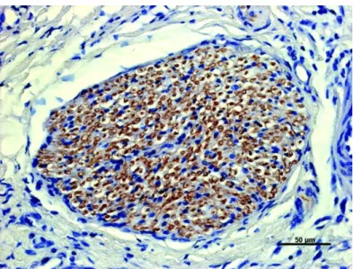 Figure 9 : Immunomarquage positif des antigènes du virus Nipah dans les axones du  nerf olfactif