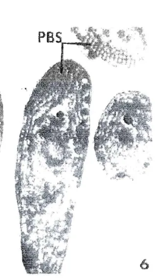 Figure 3.8.  Exemple de phycobilisomes.  Photomicrographie électronique de  phycobilisomes de  Synechococcus  lividus