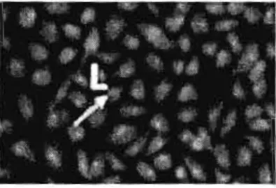 Figure 4.1  :  Image  en  microscopie  à fluorescence  de  cellules vivantes  (L)  de  la  lignée A549